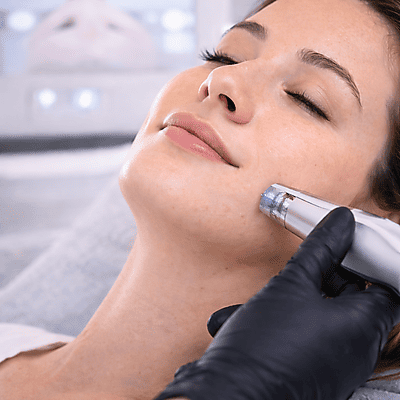 Microneedling