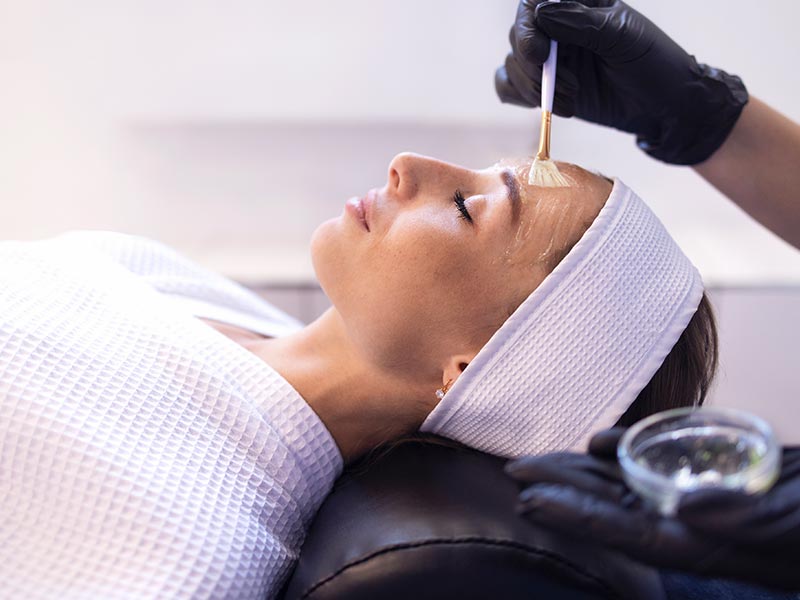 Chemical Peels