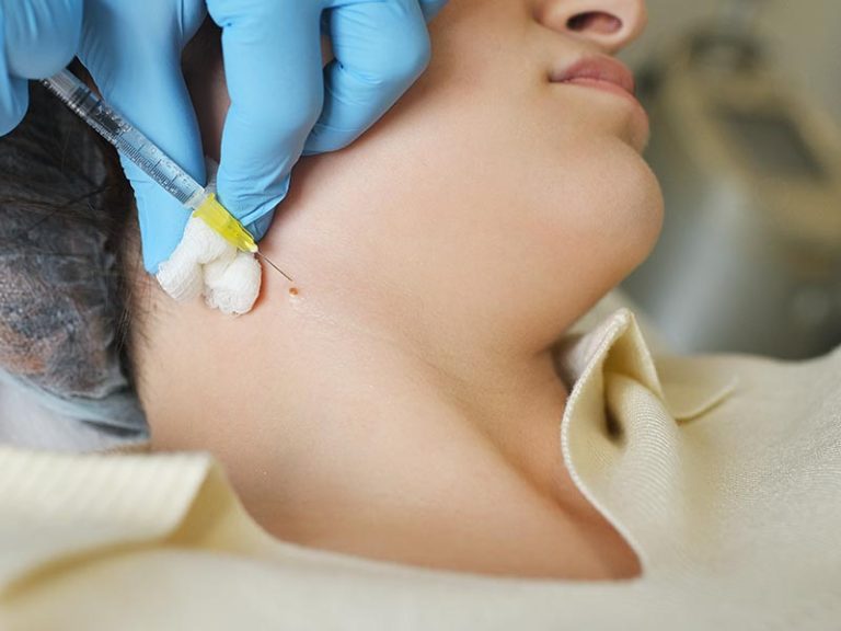 Cortisone Injections