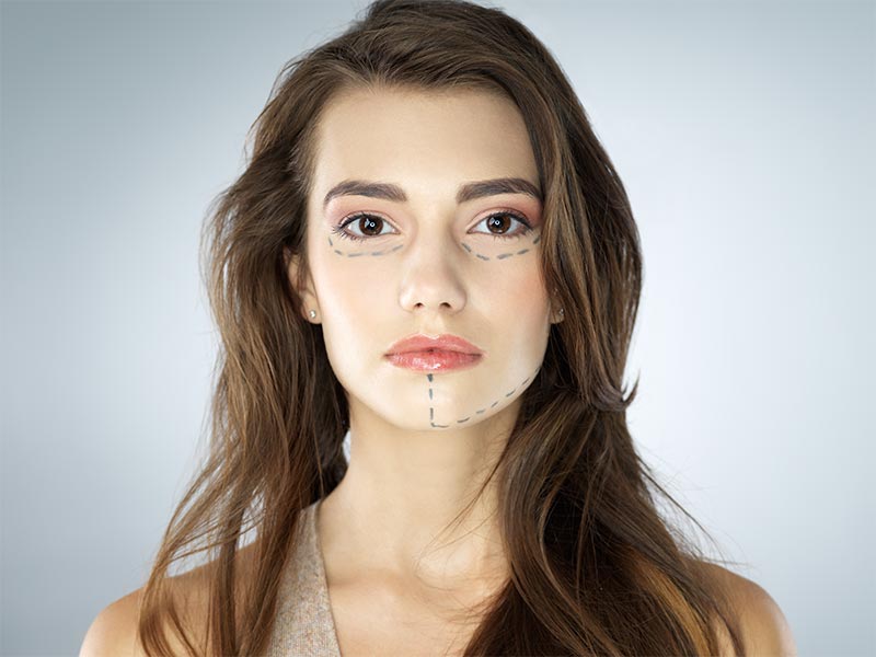 Dermatologic Surgery