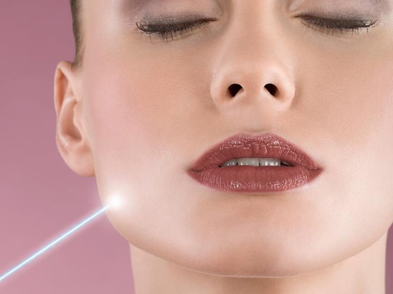 Fraxel® Laser Systems for Skin Resurfacing