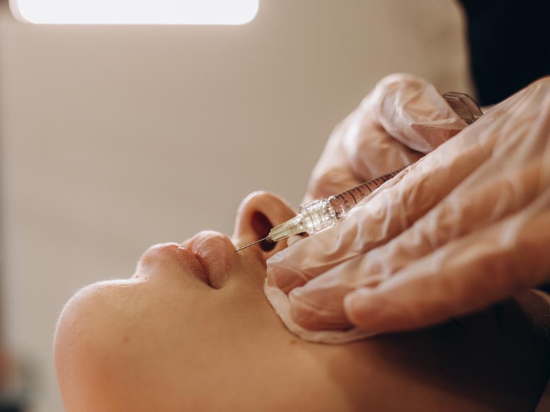 Juvéderm® XC Injectable Gel