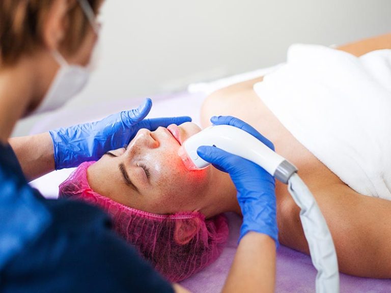 Laser Skin Rejuvenation