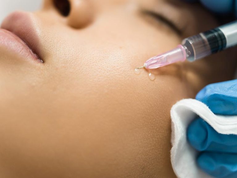 Restylane® Injectable Gel