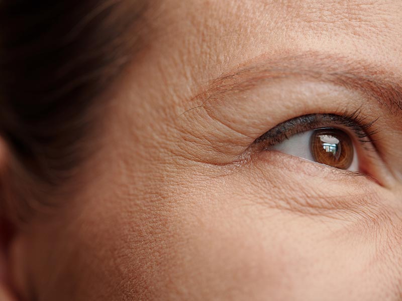 Wrinkles And Fine Lines